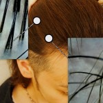 秋は-育毛 -抜け毛が増える季節です! 対策してますか?