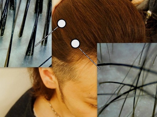 秋は-育毛 -抜け毛が増える季節です! 対策してますか?