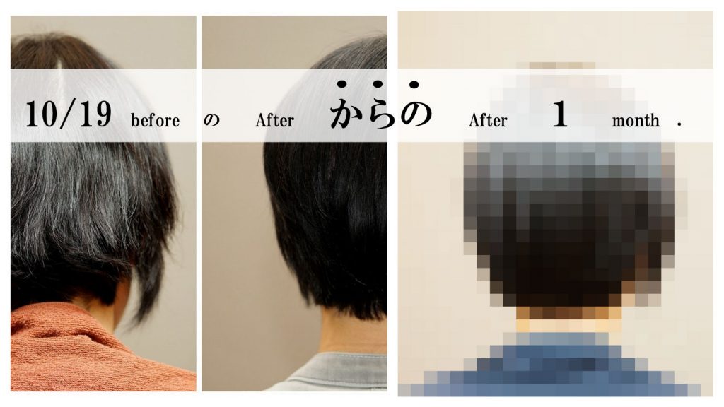 ReKERA Treatment After １ Month